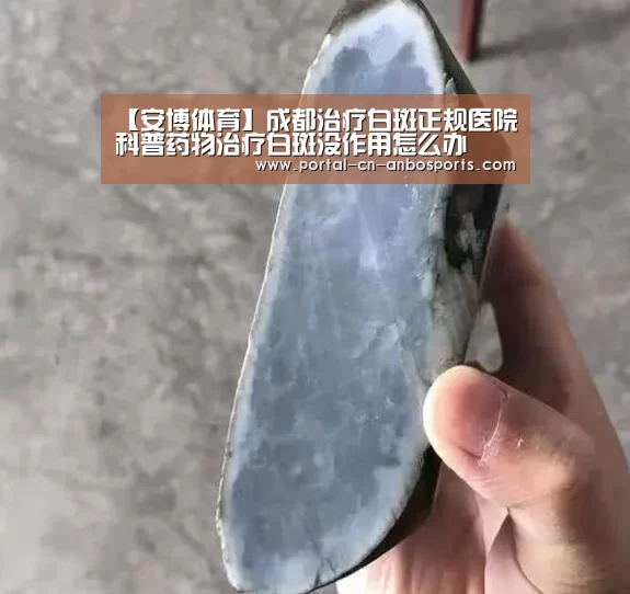 【安博体育】成都治疗白斑正规医院科普药物治疗白斑没作用怎么办(图1) 安博体育